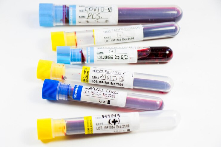 blood collection tube colour code