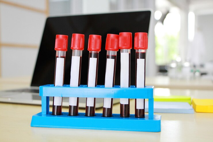 capillary blood collection tubes
