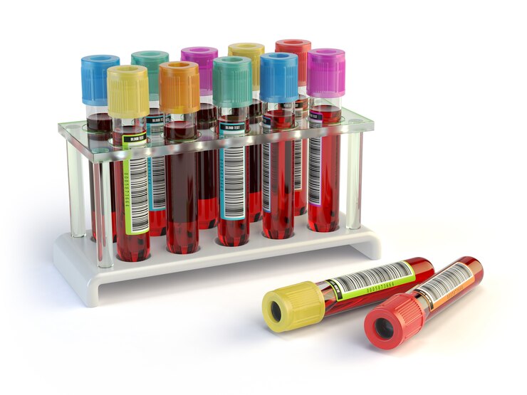 SST tubes for blood collection