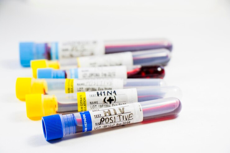color code blood collection tubes