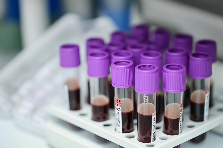 purple top tubes for blood collection