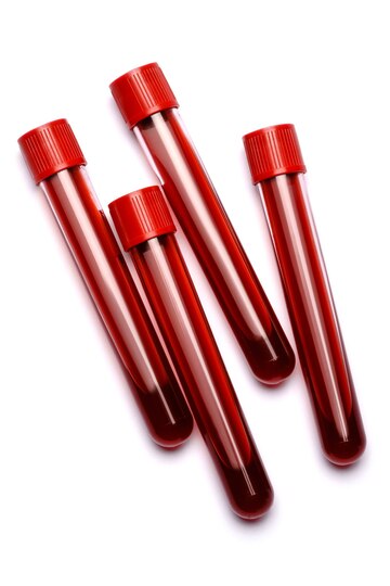 red top blood collection tubes