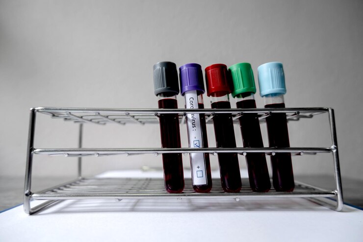 EDTA-Na2 blood collection tubes