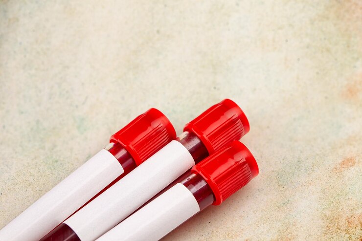 EDTA Separation gel blood collection tubes