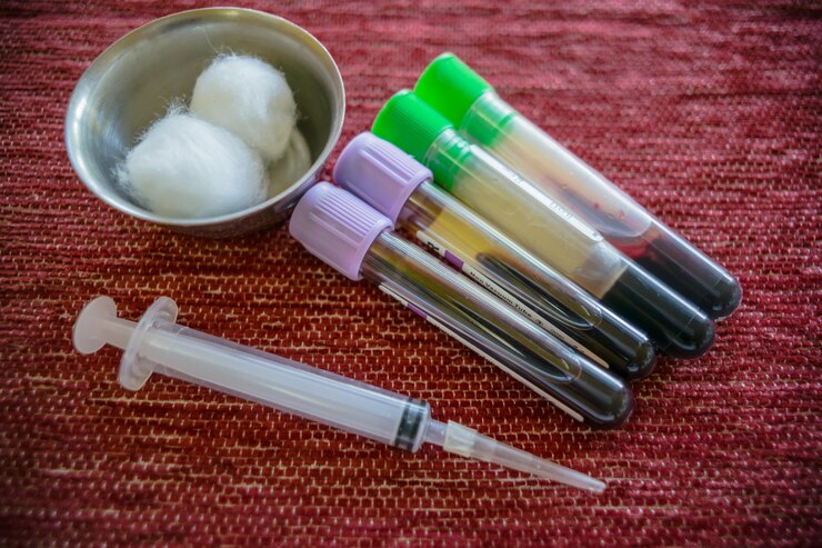 EDTA Separation gel blood collection tubes