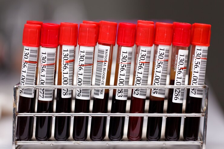 EDTAK3Sodium fluoride blood collection tubes