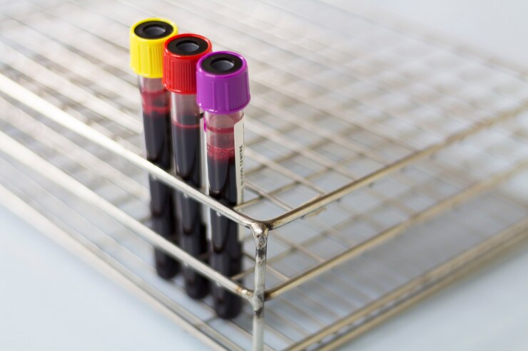 EDTAK3Sodium fluoride blood collection tubes