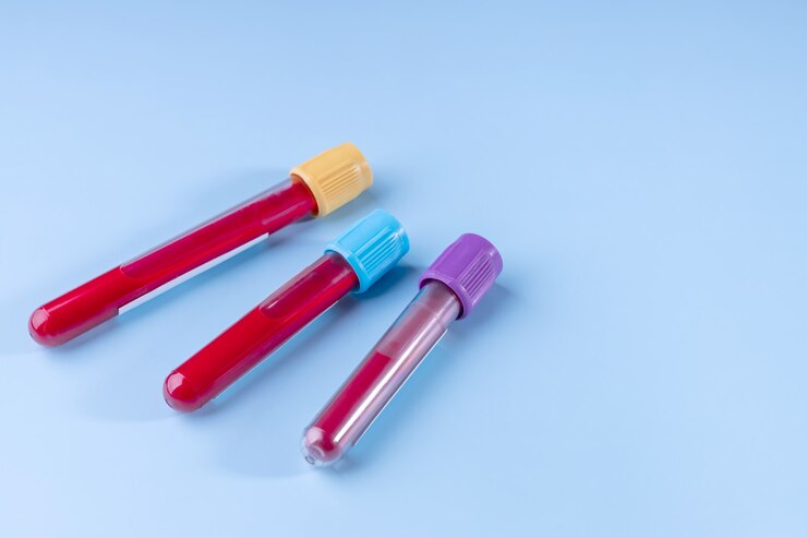 EDTAK3 blood collection tubes