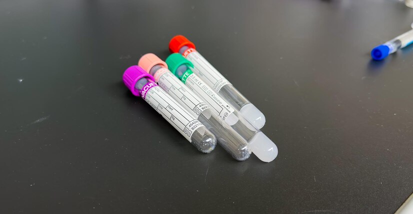 Sodium citrate Separation gel blood collection tubes