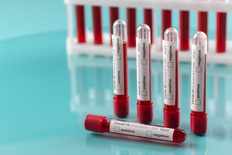 Sodium fluoride EDTA blood collection tubes
