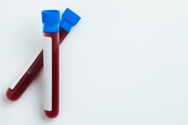 Sodium fluoride potassium oxalate blood collection tubes